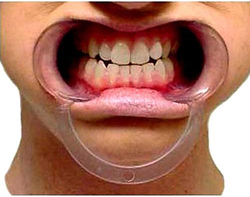 JOBEBE 15 PCS Speak out Retutor de bochecha dental assistir Ya Bocal Game C Infres