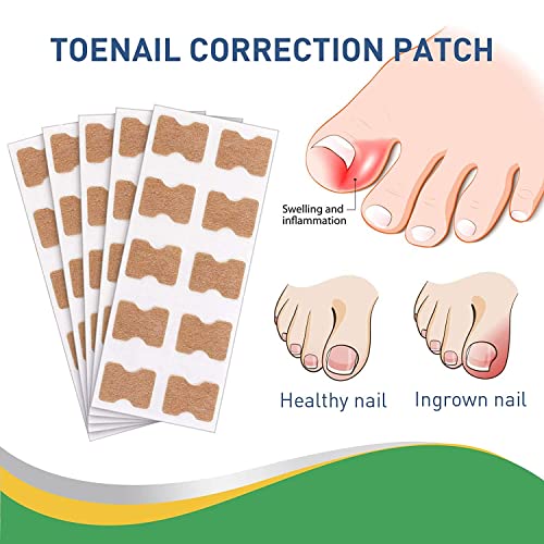 FitMedify Patches de unhas ， FIT MEDIFICE PACHES DE PUNHO DE PUNHO COM FERRAMENTO DE CORREÇÃO DO NEP, Tiras de corretor encravadas