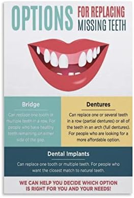 Posters Implante odontológico Cartaz odontológico Poster odontológico Poster médico Conhecimento de casa Medical Poster de tela