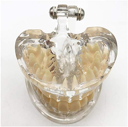 Modelo de dentes dentários KH66ZKY - Modelo de ensino de dentes dentários - modelo de dentes transparentes padrão de cristal claro,
