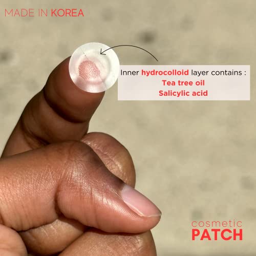 Patch cosmético | Patch invisível de cura de acne | Patch de acne hidrocolóide | Cura à vista para acne, espinhas e espinhas