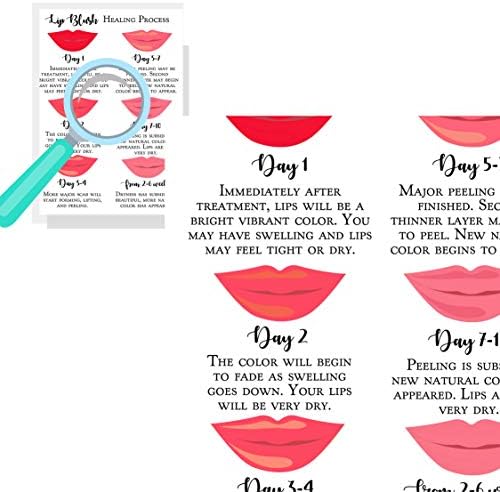 Lips Blush Stages das instruções de cura e cuidados postais | Pacote de 30 | Tamanho de dupla face 4,25 x 5,5 polegadas postais | Branco com Red Lips Design