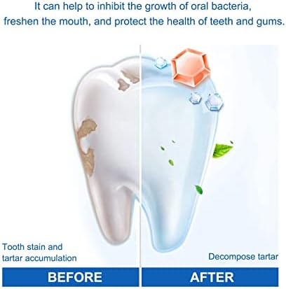 Tinta clareadora de dentes Limpeza oral e tinta de dente de beleza para remover manchas de dentes dentes dentes dentes